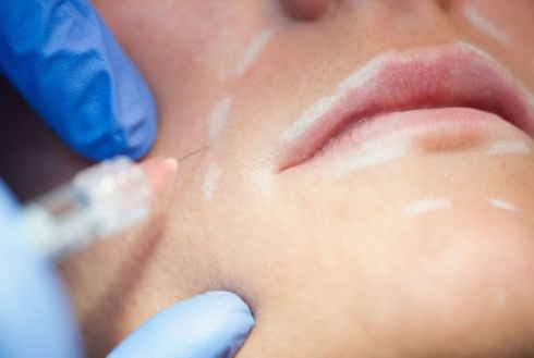 centre de médecine esthétique du Dr Ligeron à montpellier